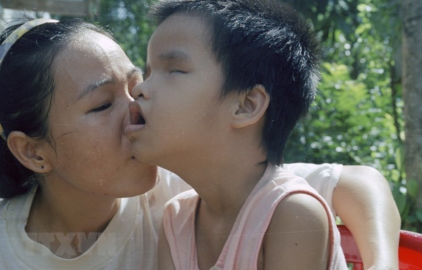 62 năm thảm họa da cam ở Việt Nam: Chung tay xoa dịu nỗi đau da cam 62 năm thảm họa da cam ở Việt Nam: Chung tay xoa dịu nỗi đau da cam