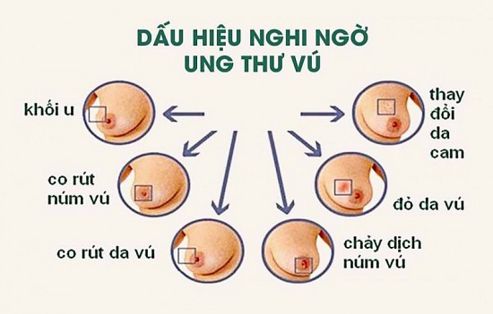nhung duong chat va thuc pham giup giam nguy co ung thu vu