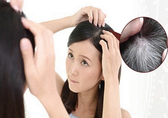 có rất nhiều các loại thực phẩm lành tính từ thiên nhiên có thể