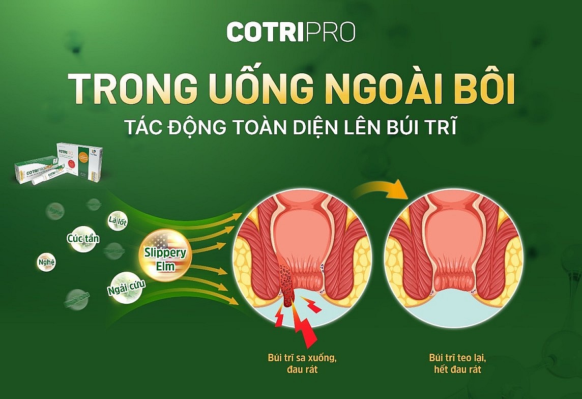 Công bố nghiên cứu tác dụng hỗ trợ điều trị trĩ của CotriPro tại Đại học Y Hà Nội