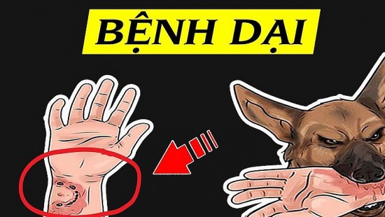 so ca tu vong do benh dai tang 30