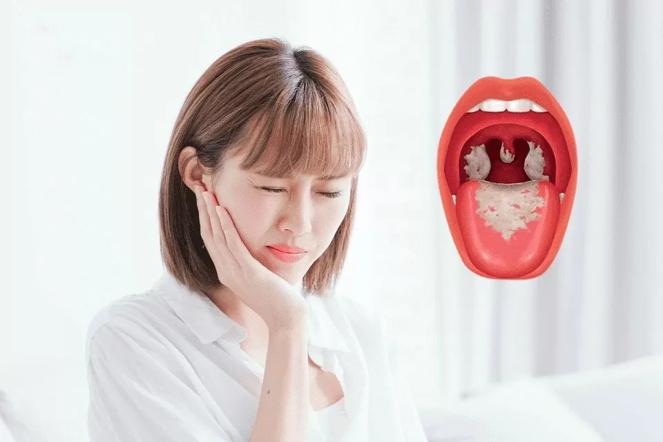Chế độ dinh dưỡng cho người bệnh bạch hầu thế nào để đảm bảo sức khỏe?