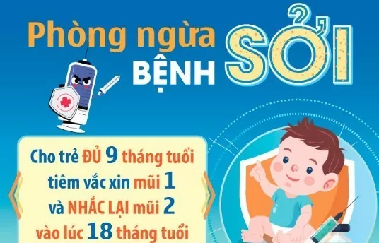 Lào Cai: Tăng cường công tác phòng, chống bệnh sởi