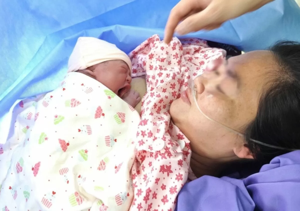 Em bé được ghép "da kề da" với mẹ. Ảnh: Bệnh viện cung cấp