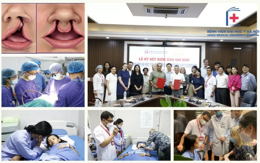 Miễn phí vé máy bay cho bệnh nhân mổ hở hàm ếch