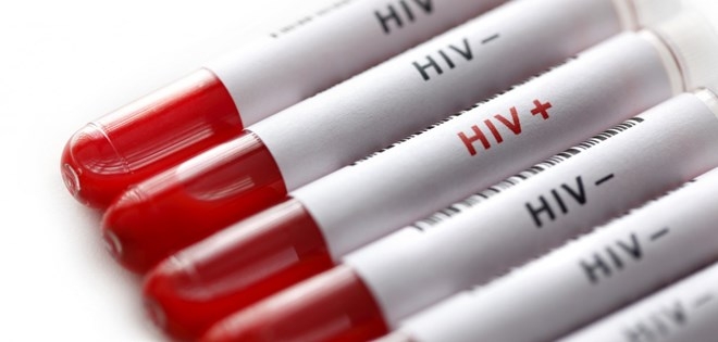 Phát hiện thuốc điều trị ung thư phổi có thể tiêu diệt các tế bào HIV