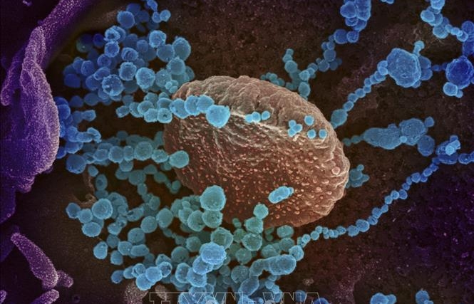 Các nhà khoa học Argentina giải mã thành công bộ gien của virus SARS-COV-2