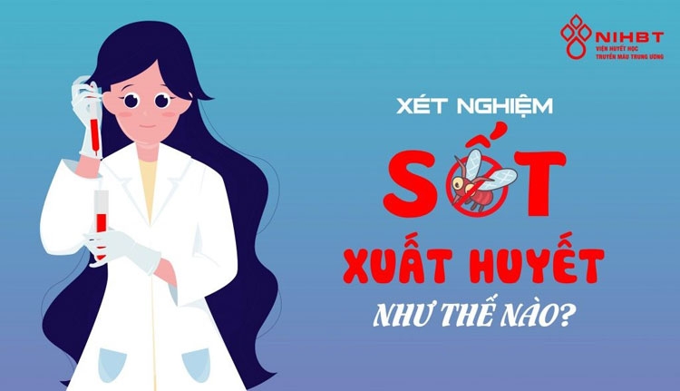 xet nghiem sot xuat huyet nhu the nao